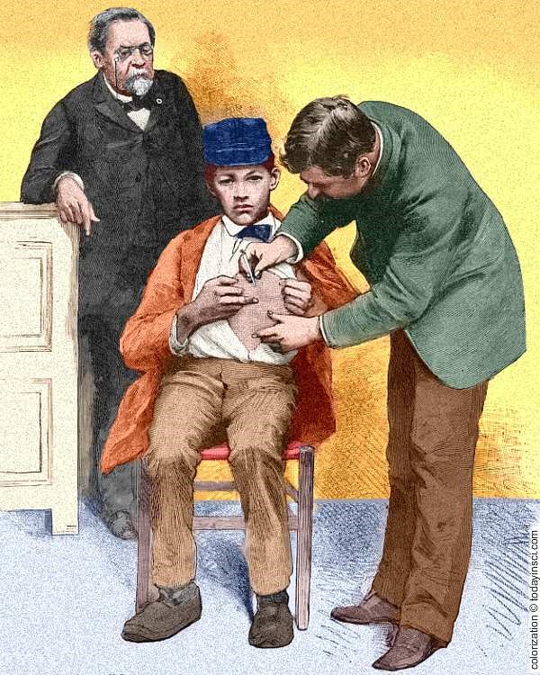 پسری که به فرانسه فرستاده شد تا واکسن هاری که توسط پاستور تولید شده بود، دریافت کند.